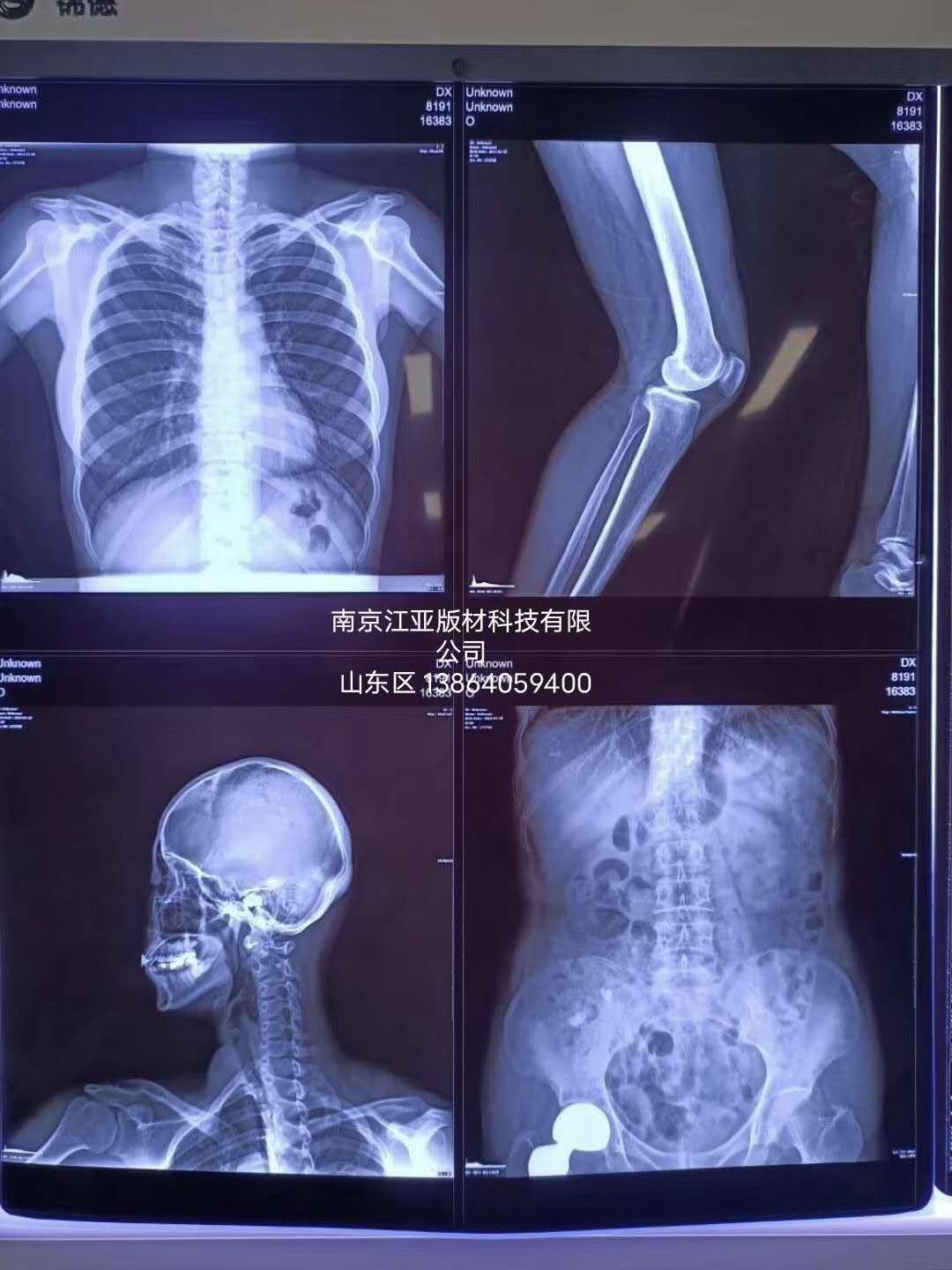 熱敏膠片