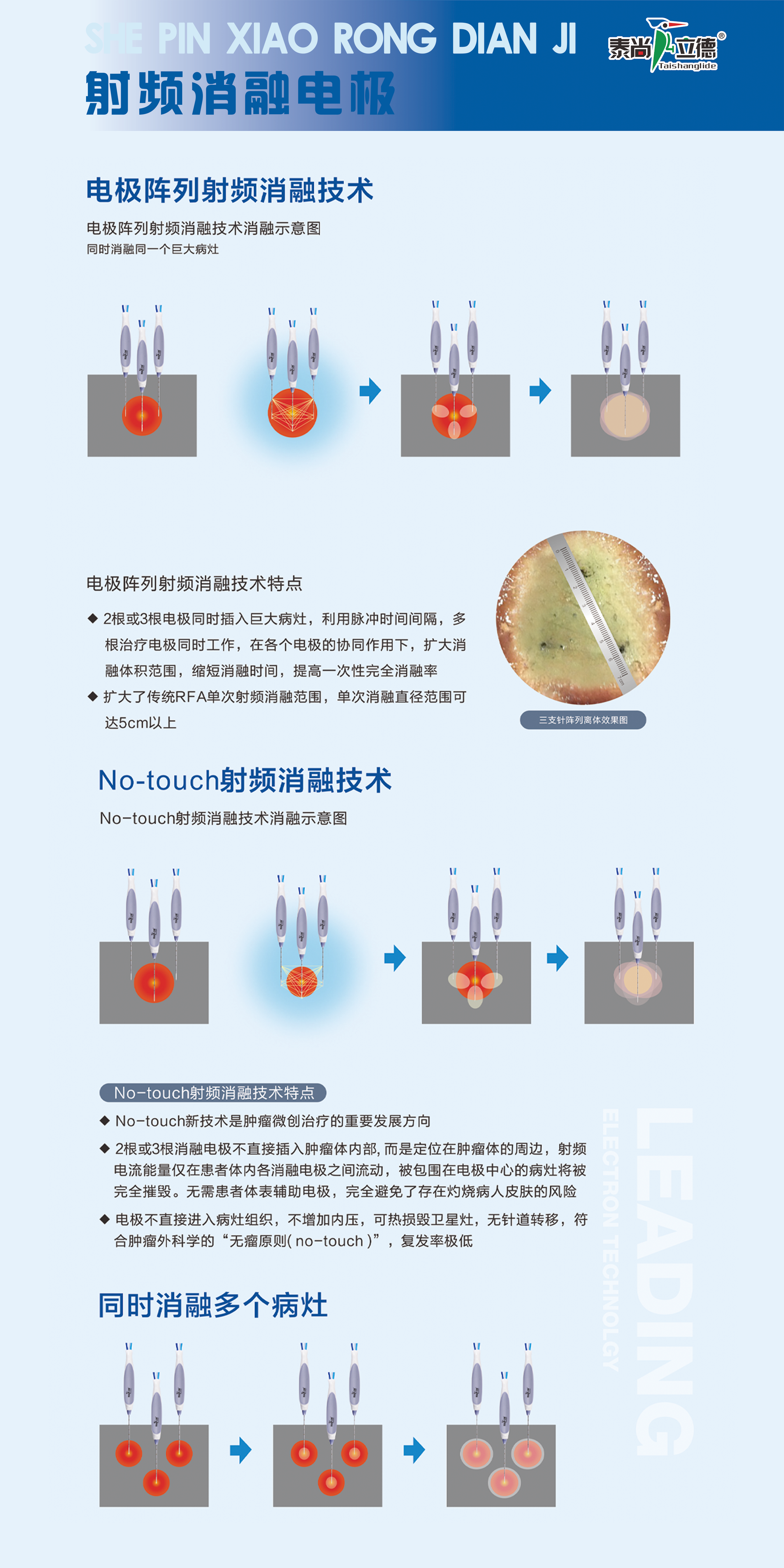 射頻消融電極 技術(shù)特點